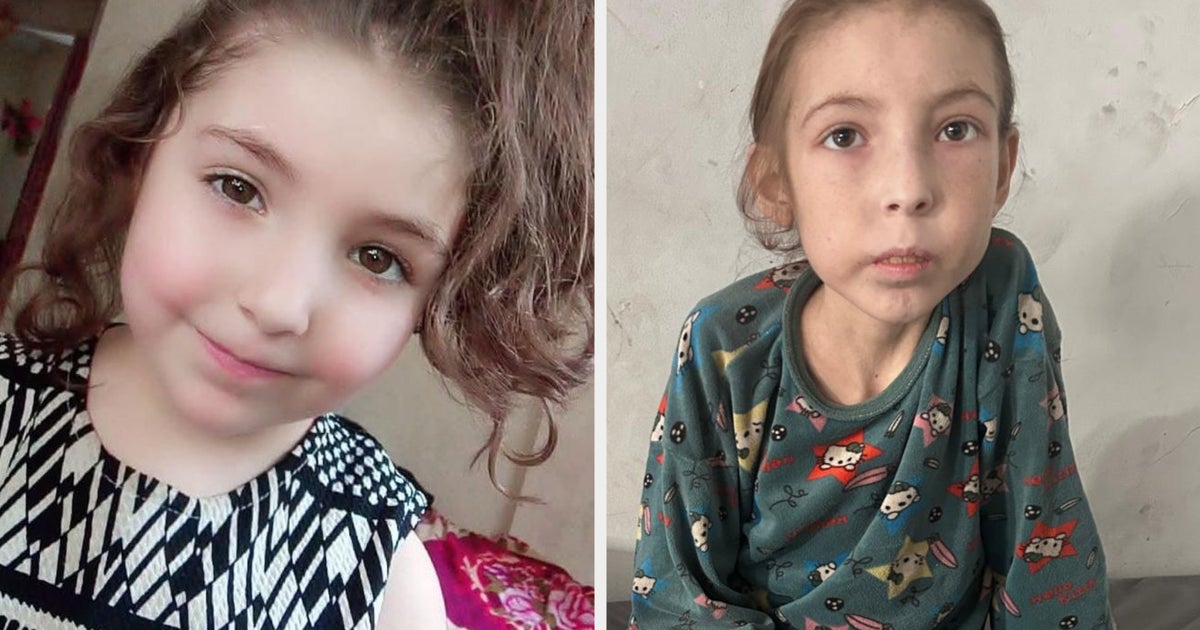 Rahaf Is 12 And Lives In Gaza. All She Wants Is For Her Hair To Grow Back