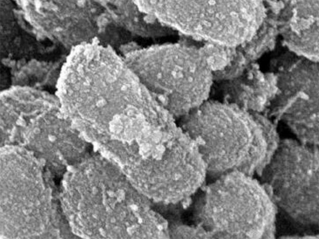 百日咳菌の電子顕微鏡画像（提供／国立健康危機管理研究機構）