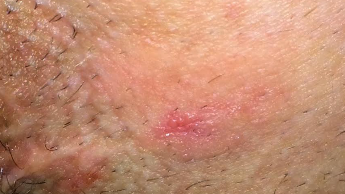 I Had An Itch In A Very Private Spot. Things Turned Tragic After I Asked My Doctor A Simple 4-Word Question.