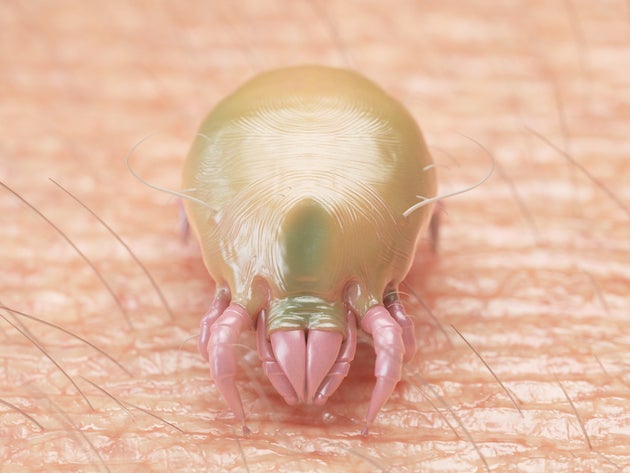 Σε μεγέθυνση ένα από τα δεκάδες οκτάποδα ακάρεα που σέρνονται έξω από τους πόρους μας για να ... διασκεδάσουν βραδινές ώρες. 