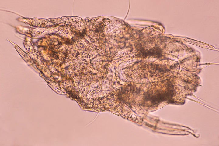 A house dust mite, magnified 100X. Mites are arachnids related to spiders, ticks, chiggers, etc. 