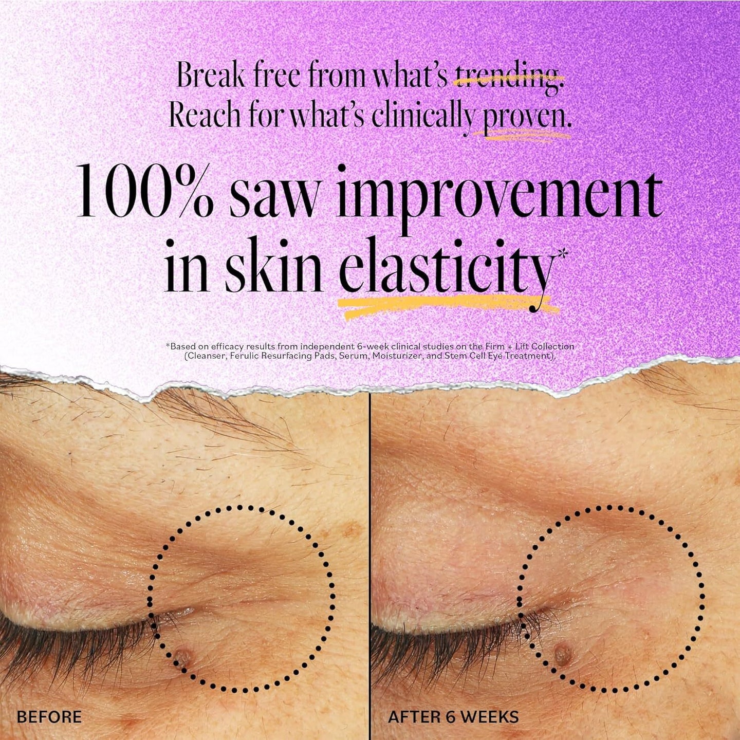 You Can Get This 'Facelift In A Tube' For Only $19 | HuffPost Life