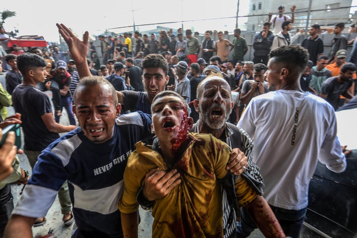 Palestinians who were injured by an Israeli attack while waiting to receive humanitarian aid are brought to Nasser Hospital in Khan Younis, Gaza on June 17, 2025.