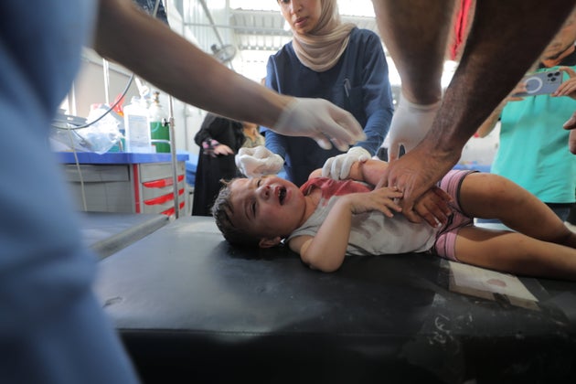 ガザ地区のブレイジ難民キャンプへのイスラエルによる空爆で負傷し、病院で治療を受けるパレスチナ人の子ども（2025年6月17日）