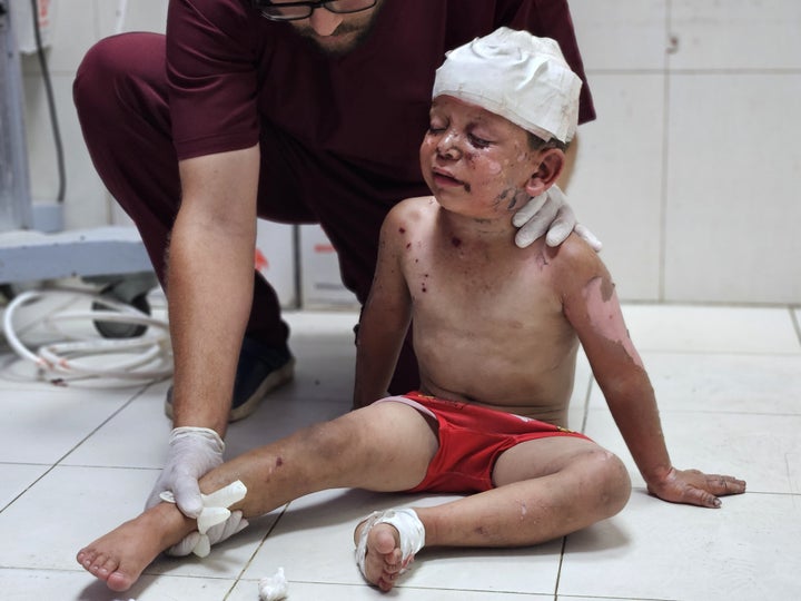 Injured Palestinian children are brought to Nasser Hospital to receive medical treatment following an Israeli attack on the Al-Mawasi area in Khan Younis, Gaza on June 22, 2025.