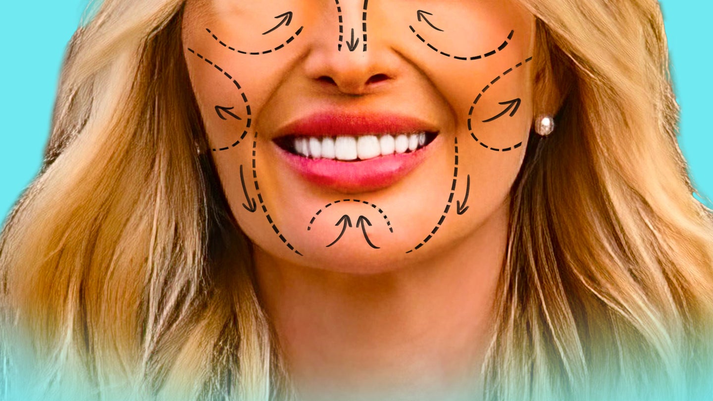 What Is Mar-a-Lago Face? Plastic Surgeons Explain | HuffPost Life