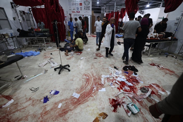 Palestinians hit by Israeli fire at a food aid distribution point run by the Gaza Humanitarian Foundation (GHF) receive care at Al-Awda Hospital in the Nuseirat refugee camp in the central Gaza Strip on June 24, 2025.