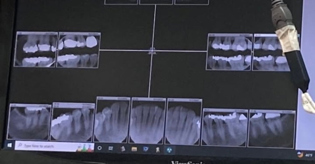 I Needed K In Dental Work. I Thought I’d Take The Secret Of How I Paid For It To My Grave. I Needed K In Dental Work. I Thought I’d Take The Secret Of How I Paid For It To My Grave.