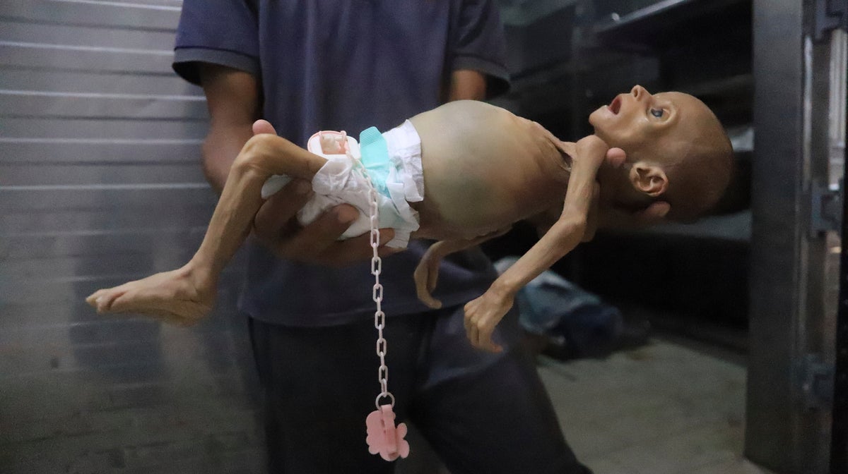 Mideast Wars Baby Starves