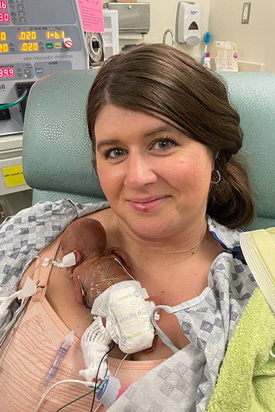 動画】妊娠21週、285グラムで生まれた「世界一の早産児」が1歳に