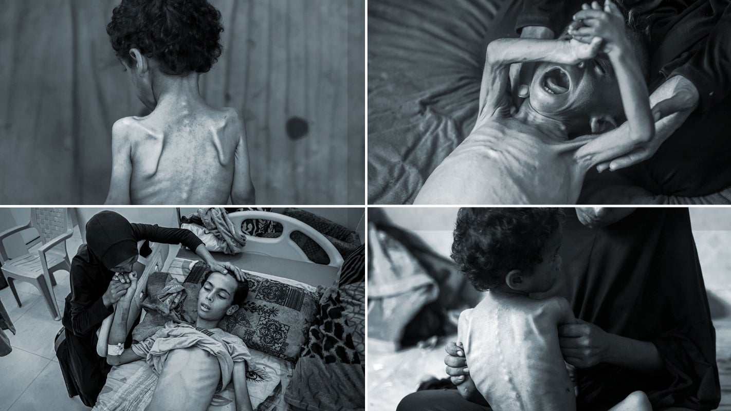 Children starving in Gaza