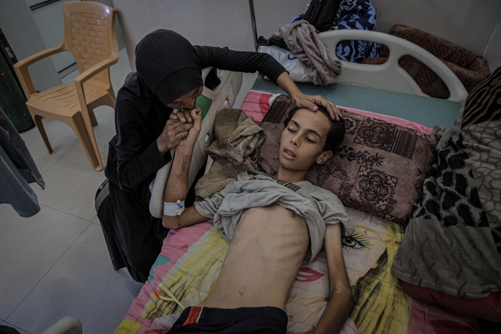 Previous ‘The Point Of No Return’: Physician Describes How Hunger In Gaza Is Driving Mass Dying 1 Palestinian teenager Atif Aid Abu Khater, weighing only 25 kilograms due to malnutrition, is receiving treatment under limited conditions at Al-Shifa Hospital in Gaza City, Gaza on July 25, 2025. The deepening humanitarian crisis and ongoing Israeli attacks and blockade in Gaza have led to severe food shortages, threatening the life of 17-year-old Abu Khater.
