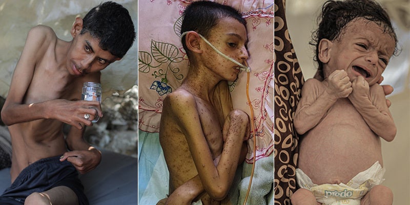 gaza famine