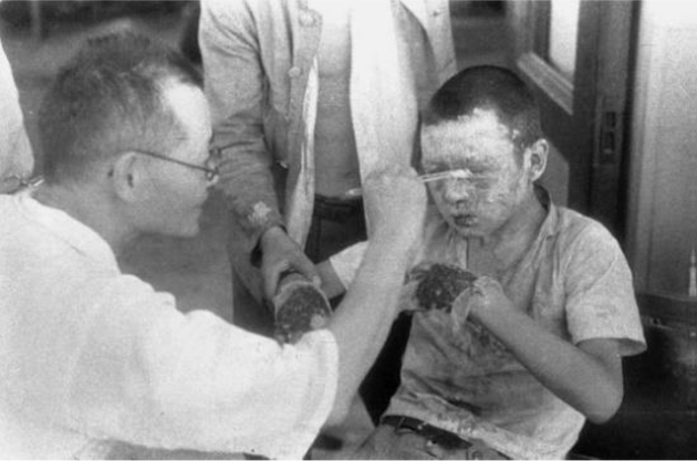 「広島赤十字病院でやけどの治療を受ける少年」宮武甫撮影