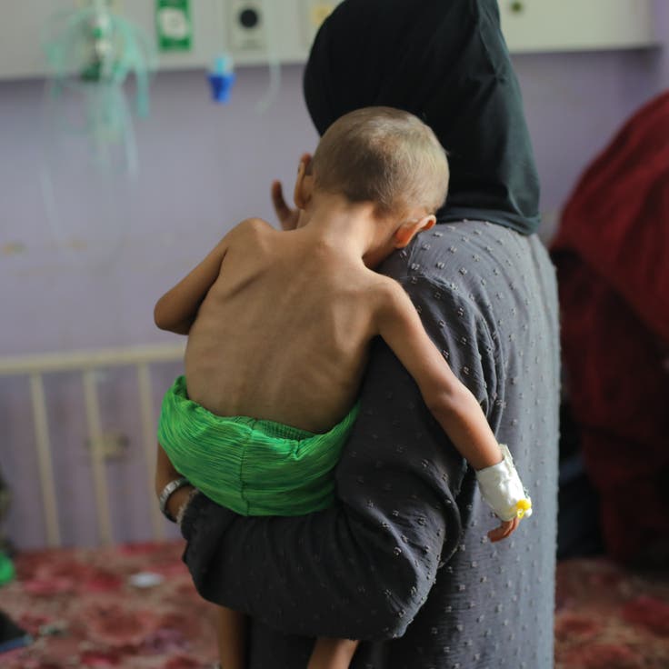 Children of various ages suffering from malnutrition are being treated with limited resources due to shortages of baby formula and medicine at Al-Aqsa Martyrs Hospital in Deir al-Balah, Gaza. Many Palestinians, especially children, have died of malnutrition and starvation as the famine caused by Israeli blockade continues.