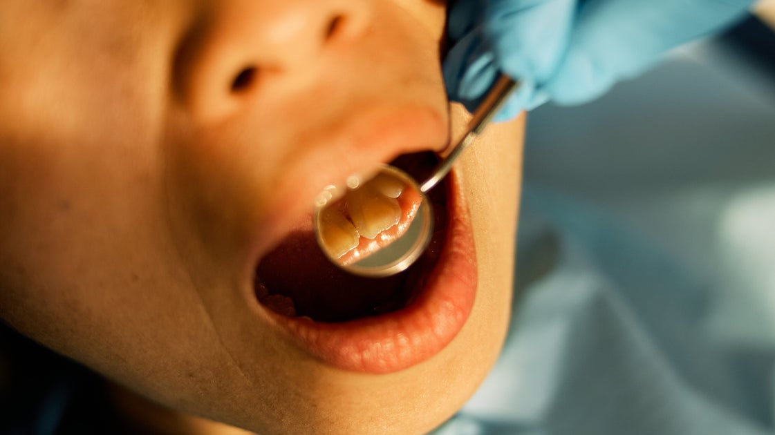 What’s Gum Disease? Signs And Symptoms To Be Aware Of.