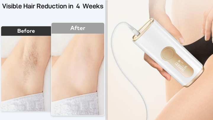 Just press the remover tool against your skin to activate the laser.