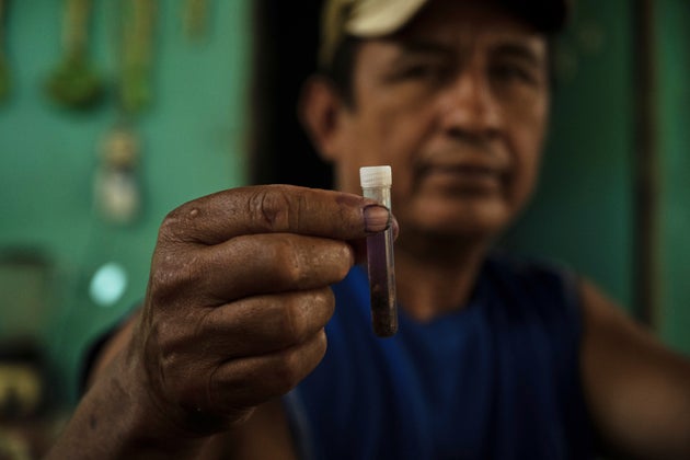 メキシコ・チアパス州の牧場で、牛から取り除かれた「ニュー・ワールド・スクリューワーム（NWS：新世界ラセンウジバエ）」の幼虫が入った試験管を持つ牧場経営者（2025年7月23日）