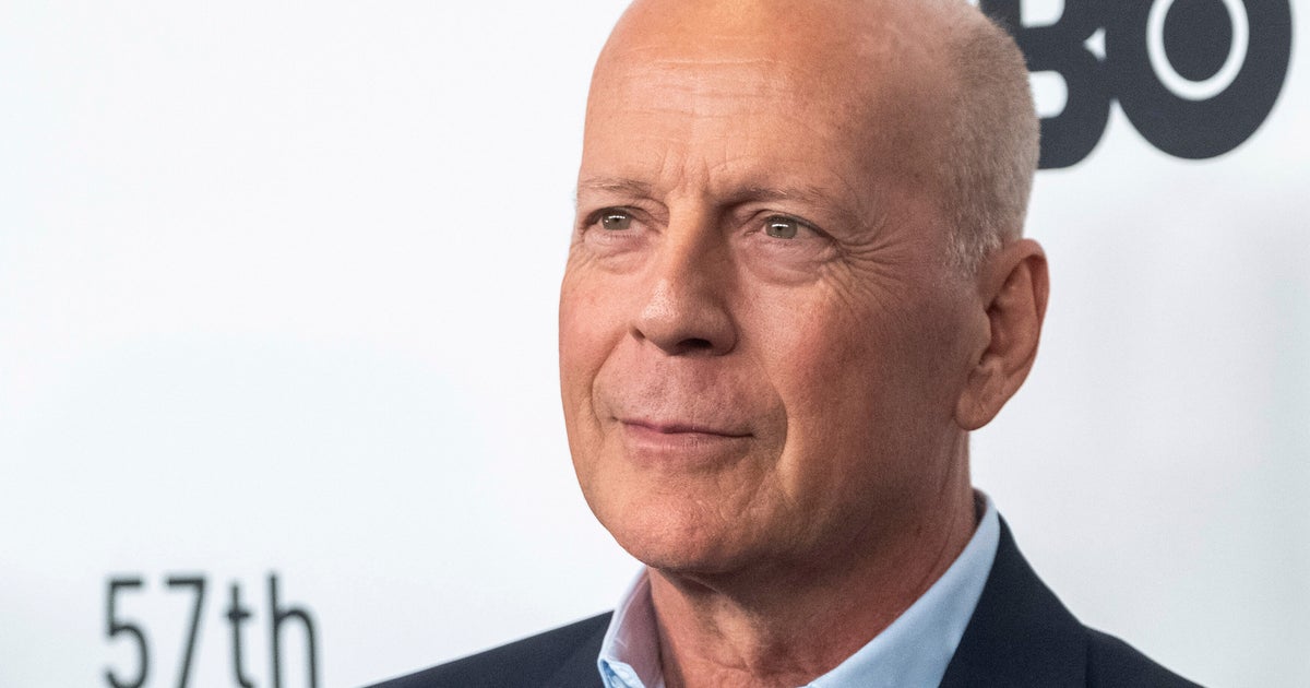 What Is Frontotemporal Dementia, The Condition Bruce Willis Is Diagnosed With?