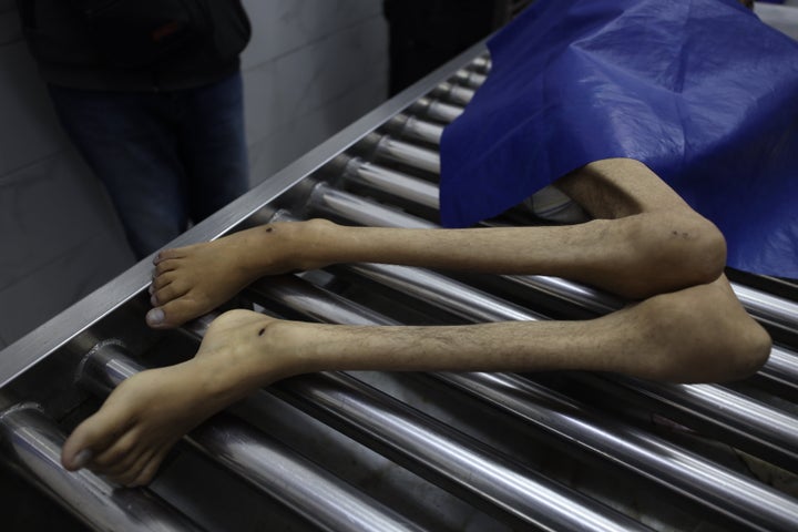 The body of Hamada Nael Warsh Agha is brought to Al-Shifa Hospital in Gaza City for funeral procedures, on Aug. 26, 2025. The 28-year-old Palestinian man died from malnutrition caused by Israel's intense blockade and aid restrictions that have severely limited access to basic food supplies in Gaza.