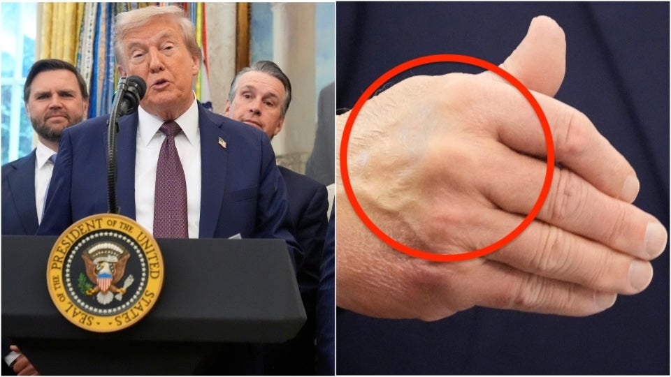 President Donald Trump