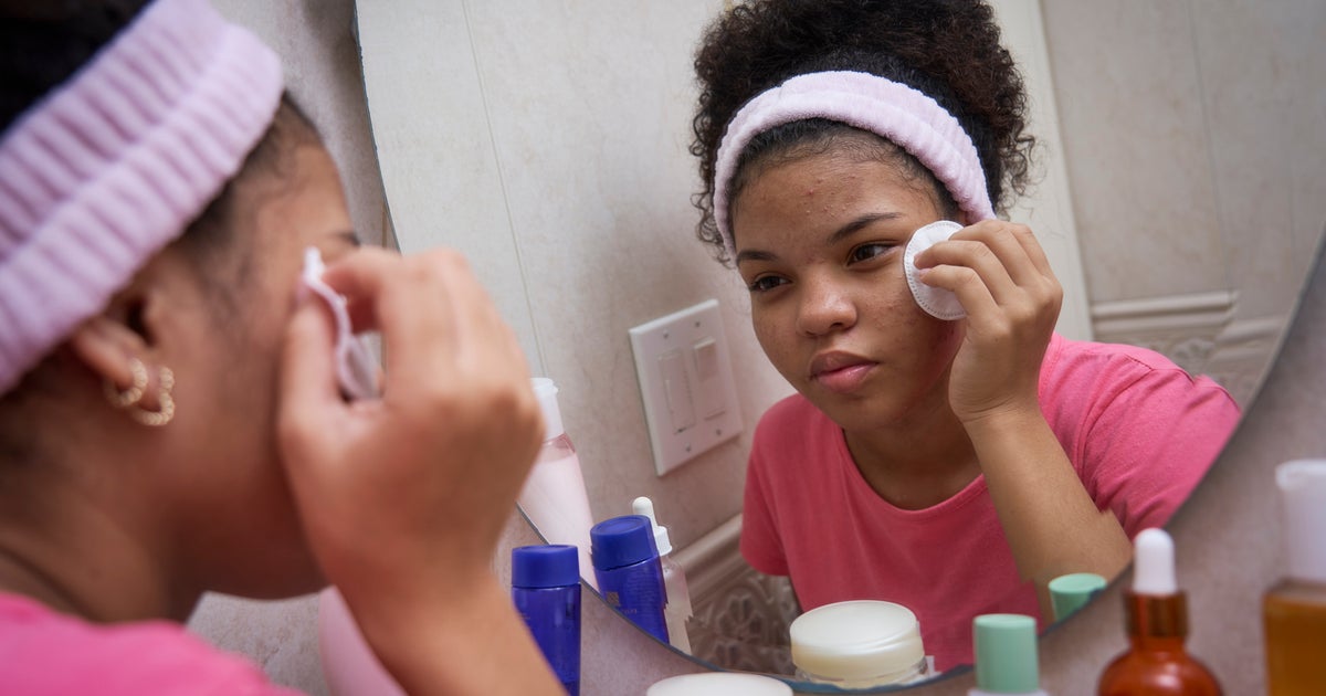 7 Dermatological Issues Often Missed On Skin Of Colour | HuffPost UK Life