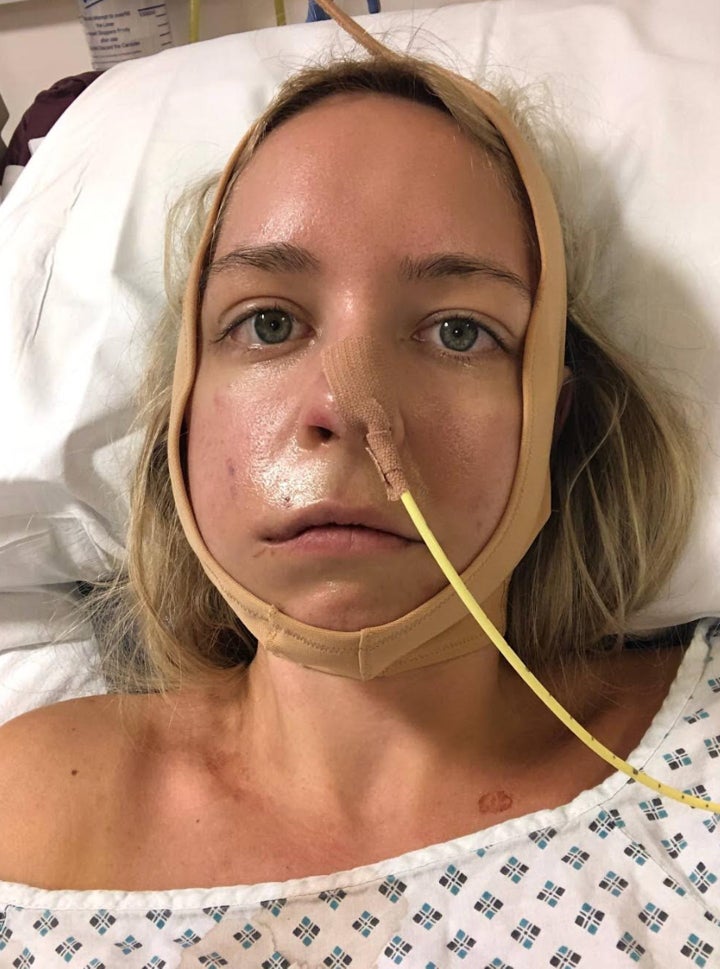 笑顔再建手術を受けた後の著者（2020年）