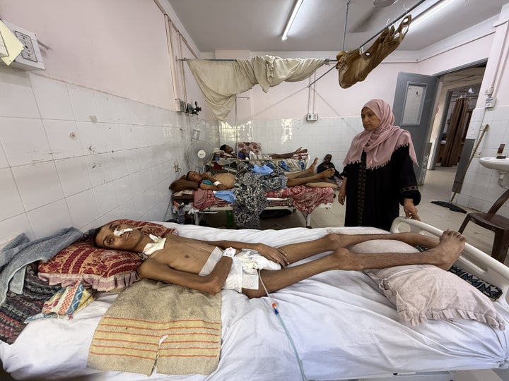 Palestinian Ahmad Saadi Abdulqader, 17, receives medical treatment at Gaza City's Al-Aqsa Hospital on Sept. 12, 2025, after Israeli forces shot him in the head while he was searching for food.