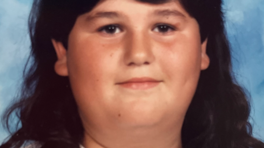 I Had My Stomach Stapled At 14 Years Old. That Surgery Didn't 'Cure' Me