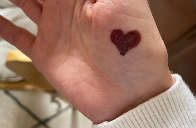 An example of how a 'cuddle button' could be drawn on a hand.