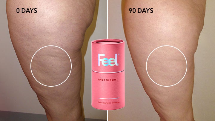The UK's First Anti-Cellulite Supplement Promises Smoother Skin – Here's How It Works