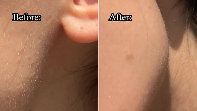 Before using a Nimbi dermaplaner (left) and after (right)