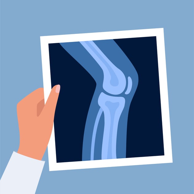 「レントゲン」や「X線」。その名前の由来とは？