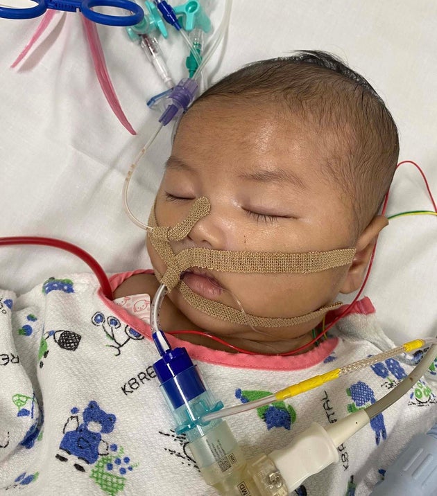 スイッチ手術成功後の信くん