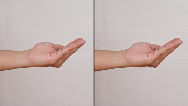 Can simple hand exercises really prevent dementia?