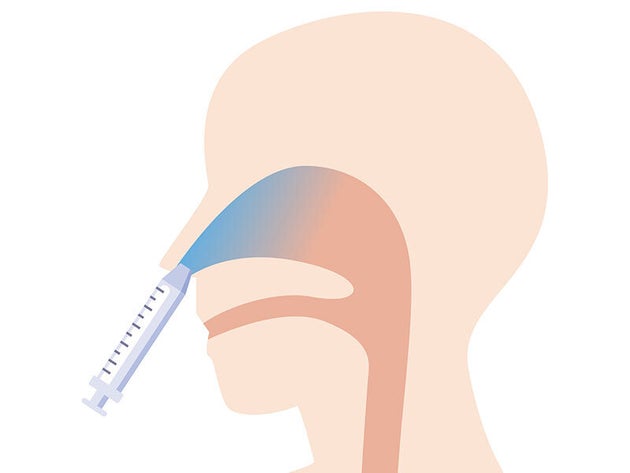 鼻スプレータイプは注射タイプよりも流通量が多くないため予約が取りずらい