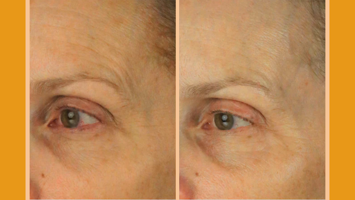 From left to right: Before use, after 12 weeks of use.