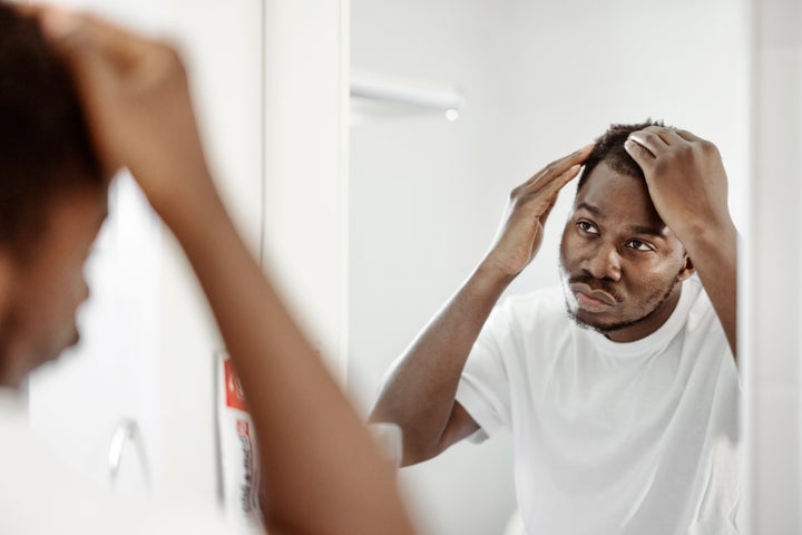 Hair loss related to high cortisol levels “generally occurs roughly three months after an immense stressor and reverts to normal three months after the stressor has subsided,” explained Dr. Michelle Draznin.