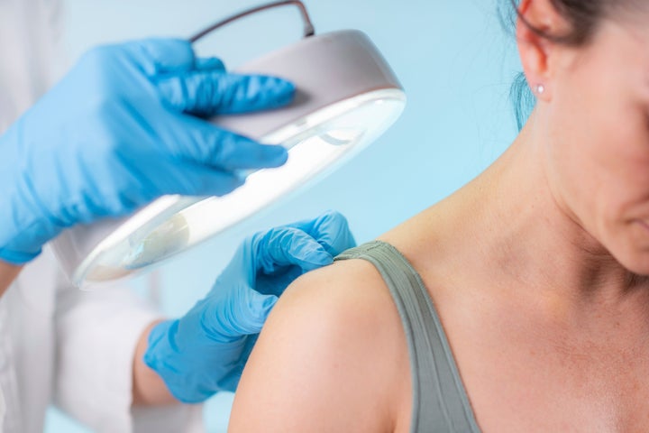 The Signs Of Stress In Your Skin | HuffPost Life