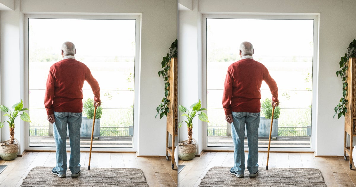 Common Physical Signs Of Dementia