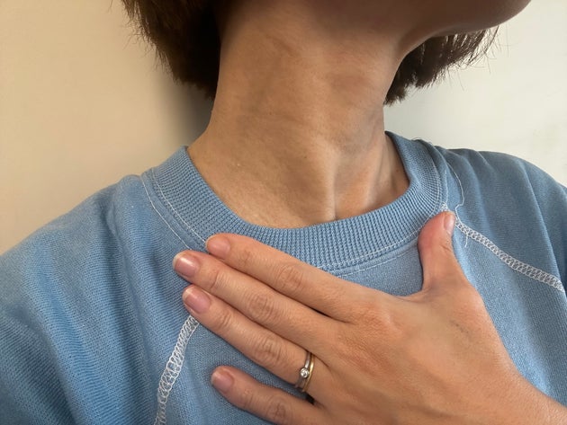 できてしまった深くくっきりとした首のシワ