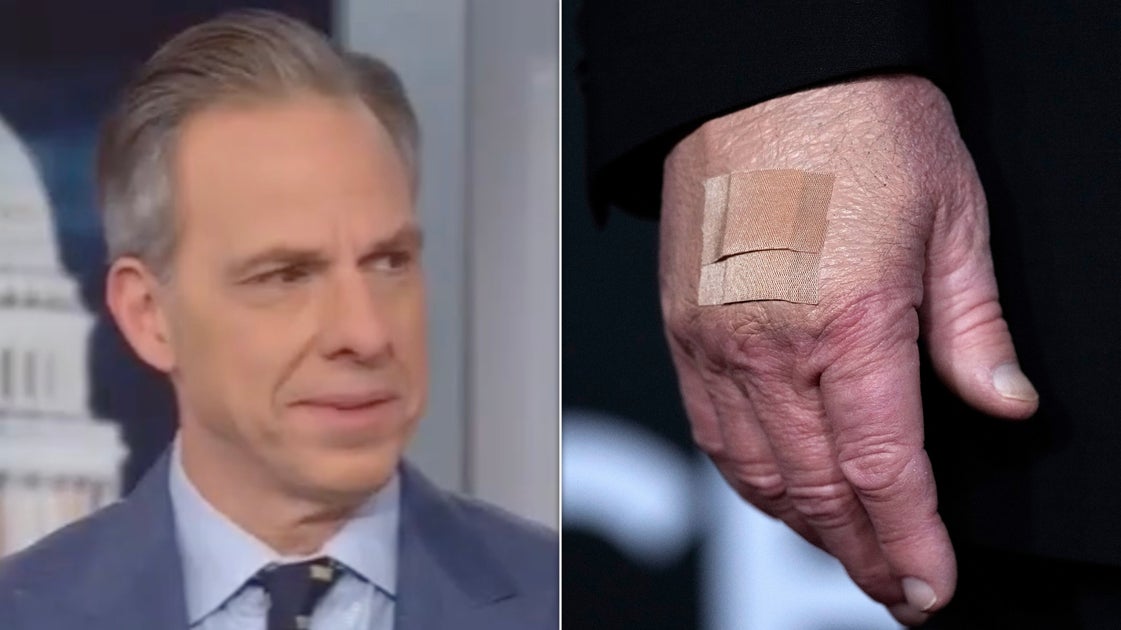 Jake Tapper Rejects White House Reason For Trump's Bruises: 'There Is Something Going On'