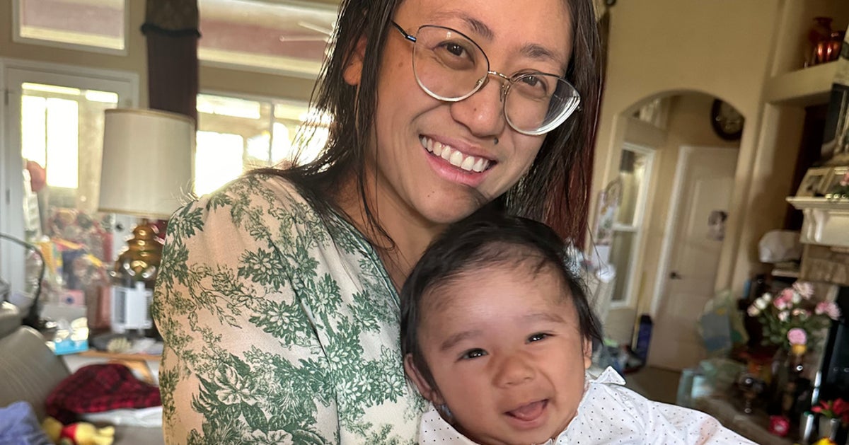 Doctors Deliver Surprise Baby While Removing Mom's 22-Pound Cyst