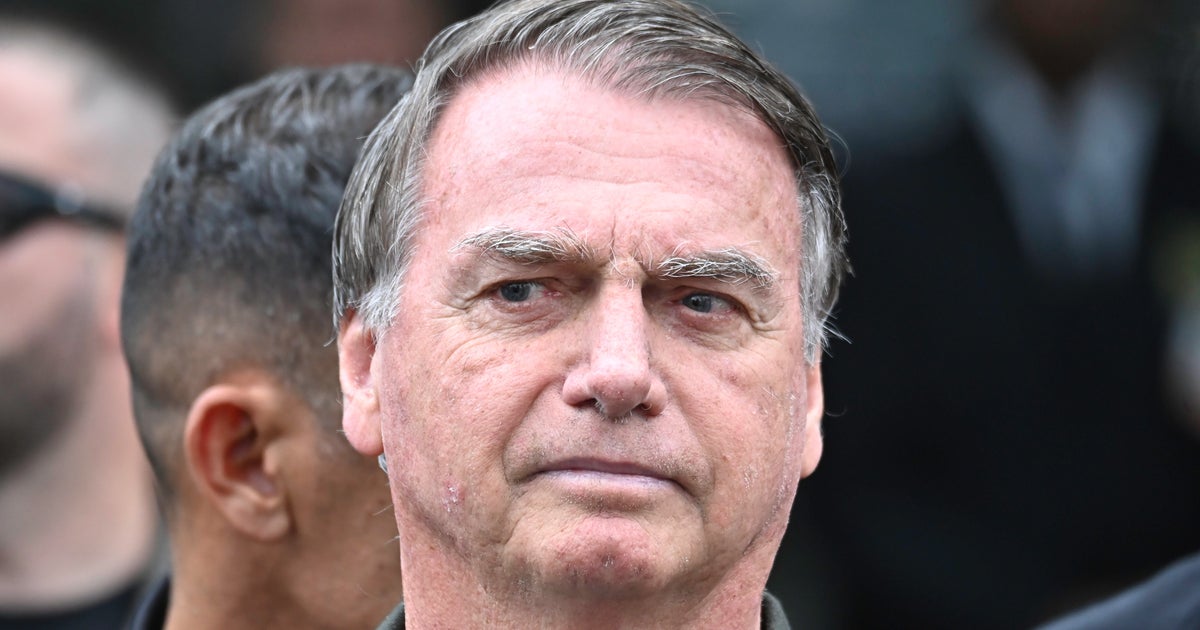 Jair Bolsonaro Backs Son’s Brazil Presidential Bid, Undergoes Hernia Surgery Jair Bolsonaro Backs Son’s Brazil Presidential Bid, Undergoes Hernia Surgery