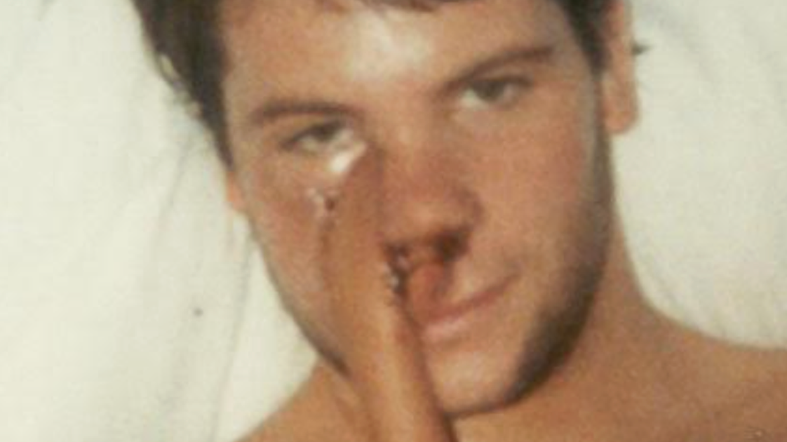 I Was A Confident 21-Year-Old. Then I Woke Up With A Tube Of Skin Connecting My Cheek To My Chest