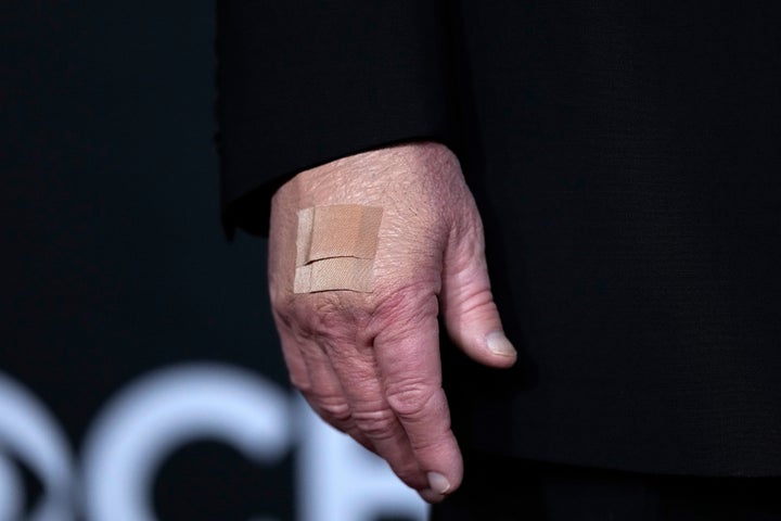 A bandage is seen on the hand of President Donald Trump while he walks the red carpet before the 48th Kennedy Center Honors, Sunday, Dec. 7, 2025, at the John F. Kennedy Center for the Performing Arts in Washington. (AP Photo/Julia Demaree Nikhinson)
