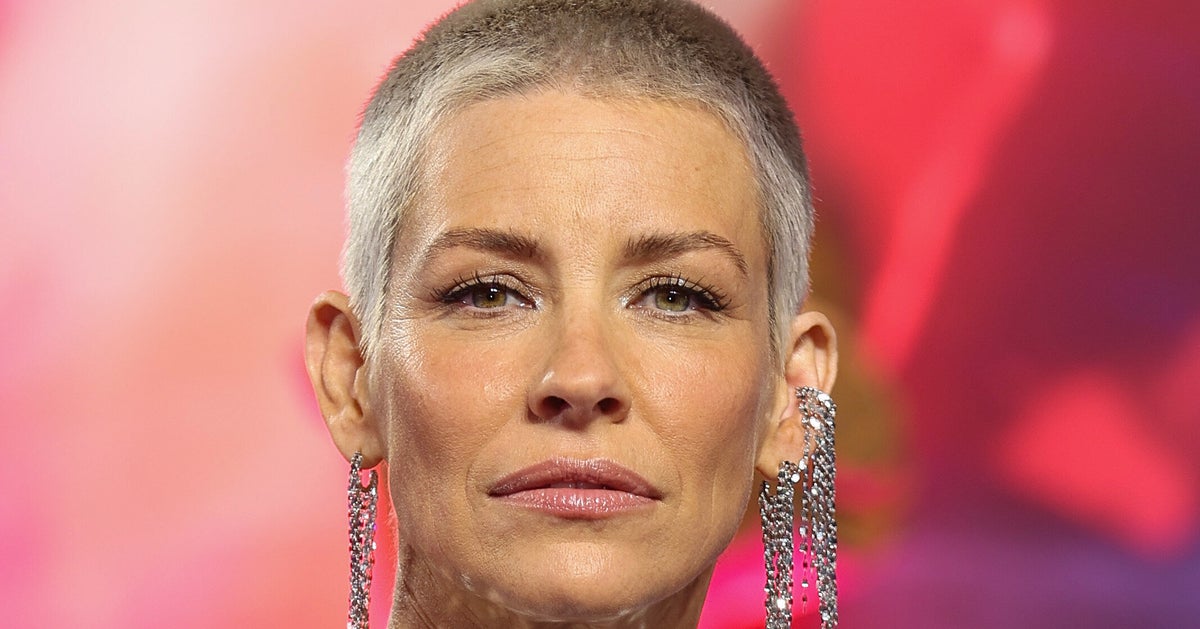 Evangeline Lilly Shares Update After Major Face Injury