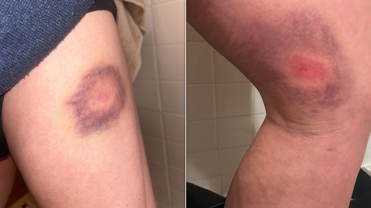 John Abernathy says he sustained several injuries after being hit with pepper bullets and tackled by federal officers.