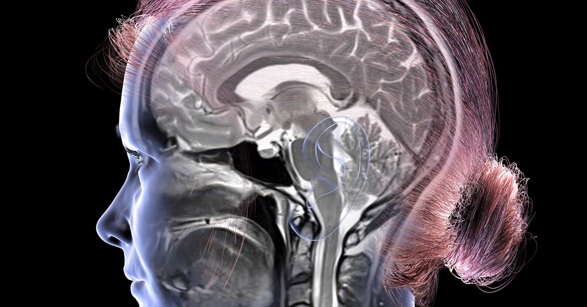 Study Suggests That This Amount Of Weekly Exercise May Help Keep Your Brain Younger