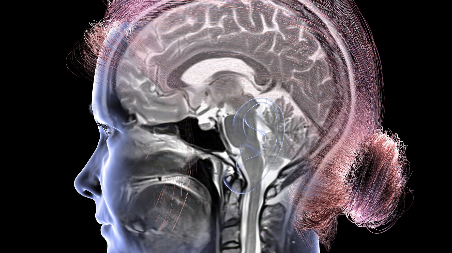 Study: 150 Minutes of Weekly Aerobic Exercise May Keep Your Brain Younger